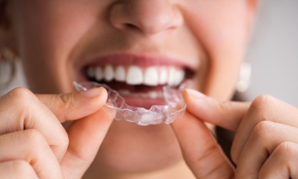 Clear Aligner Dental Night Guard For Teeth