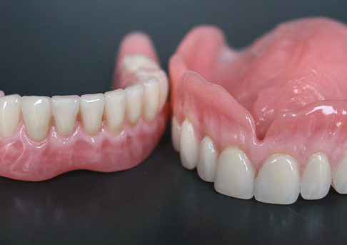 protesi dentale rimovibile