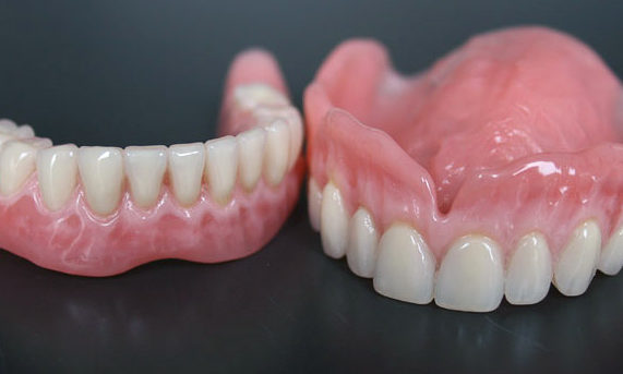 protesi dentale rimovibile