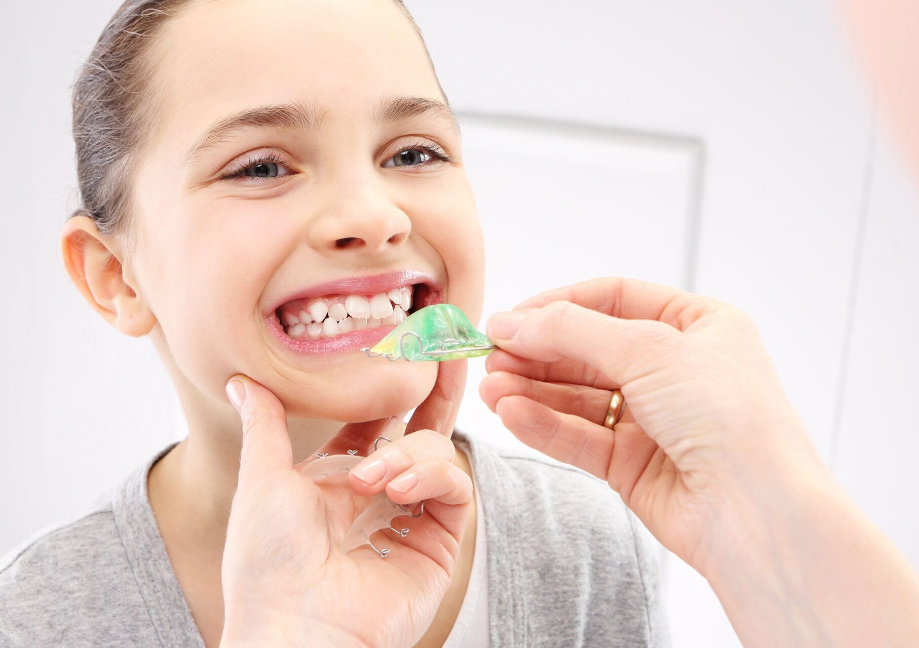 ortodonzia-classica-e-invisibile-2