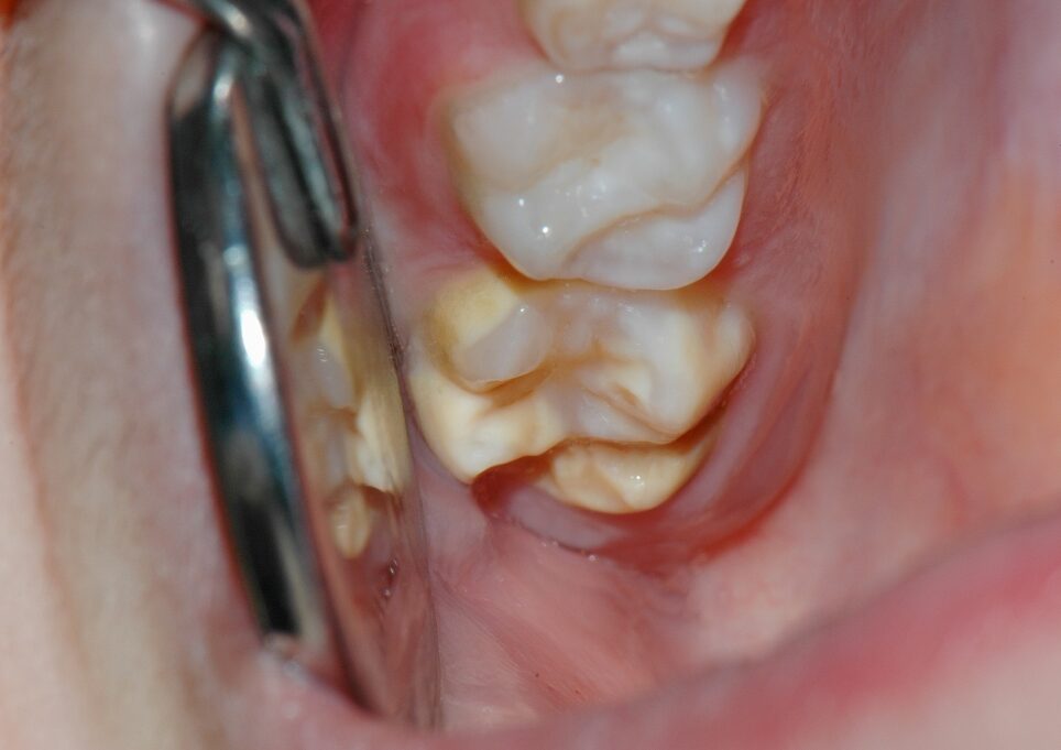 DSC_0036-Modifica_m_1024x681